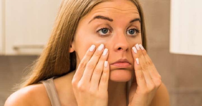 Como eliminar olheiras com tratamentos caseiros